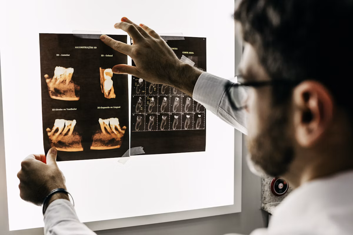 Tandarts bekijkt röntgenfoto's van een gebit bij Amermondzorg Tandartsen